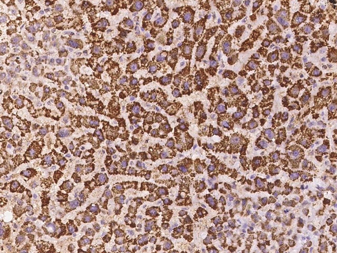 Polyclonal Rabbit anti-Human LOC388813 Antibody (IHC)