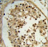 Polyclonal Rabbit anti-Human ELOVL2 Antibody (aa1-27, IHC, WB)