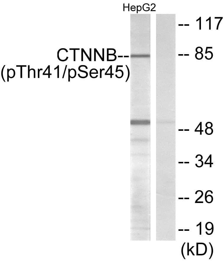 Polyclonal Rabbit anti-Human CTNNB1 / Beta Catenin Antibody (phospho-Thr41, WB)
