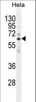 Polyclonal Rabbit anti-Human HYAL2 Antibody (aa385-412, IHC, WB)
