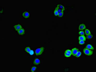 GLT8D1 Antibody