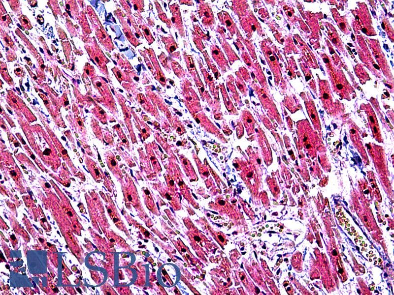 IHC-plus™ TINF2 Antibody (aa341-354)