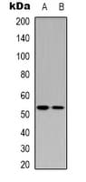 Polyclonal Rabbit anti-Human TP53 / p53 Antibody (Acetyl-Lys370, WB)