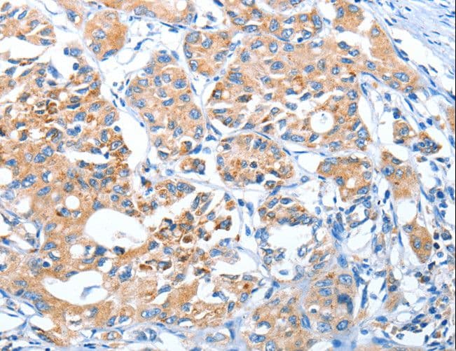 AUP1 Antibody