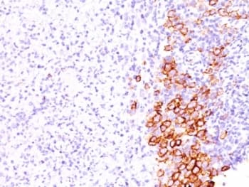 CD30 Antibody (clone SPM609)