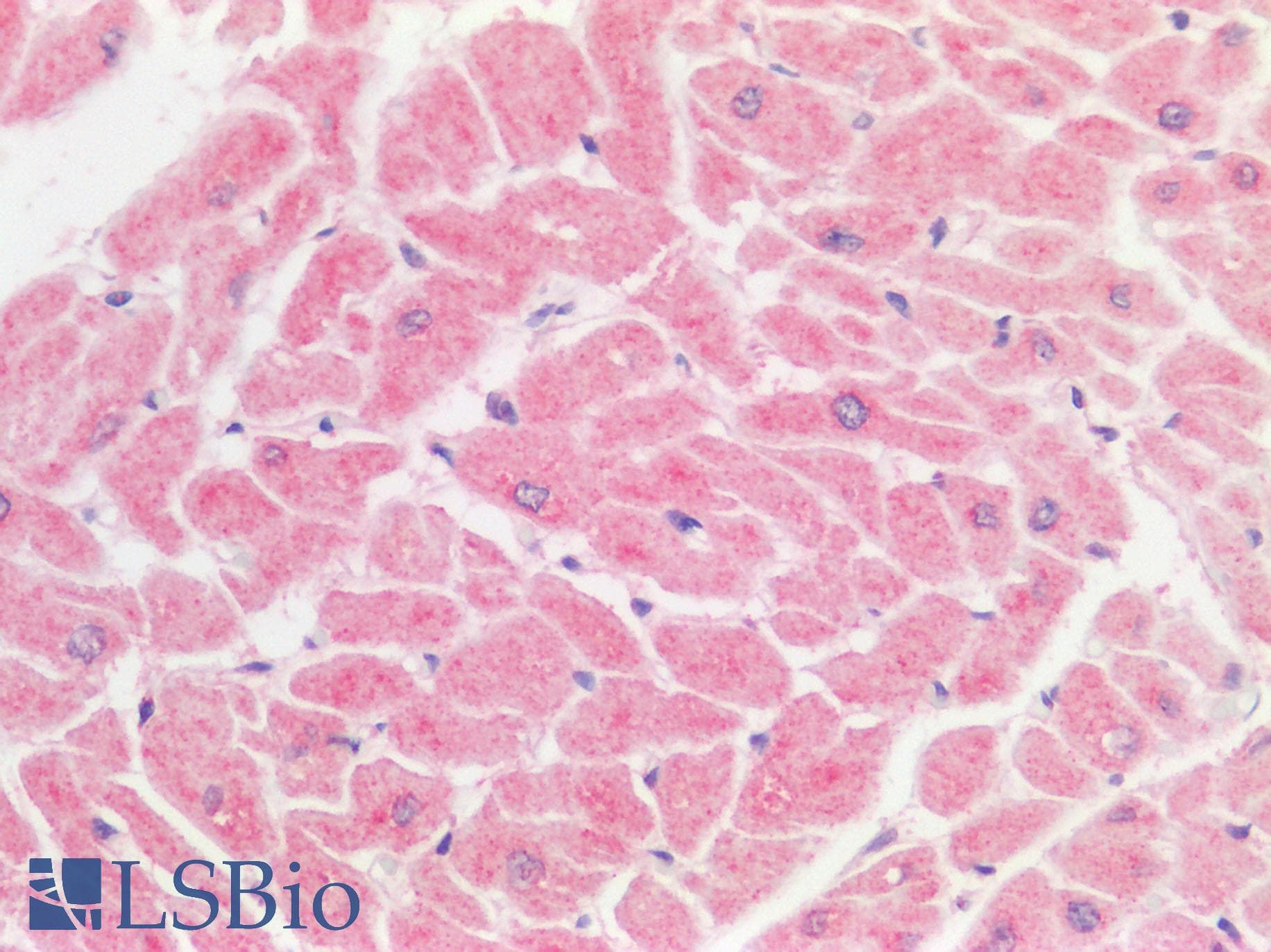 Polyclonal Rabbit anti-Human TSLP Antibody (IHC, IF, WB)