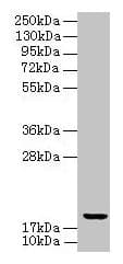 Polyclonal Rabbit anti-Human UBE2G2 Antibody (IHC, WB)