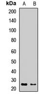 LCN2 / Lipocalin 2 / NGAL Antibody