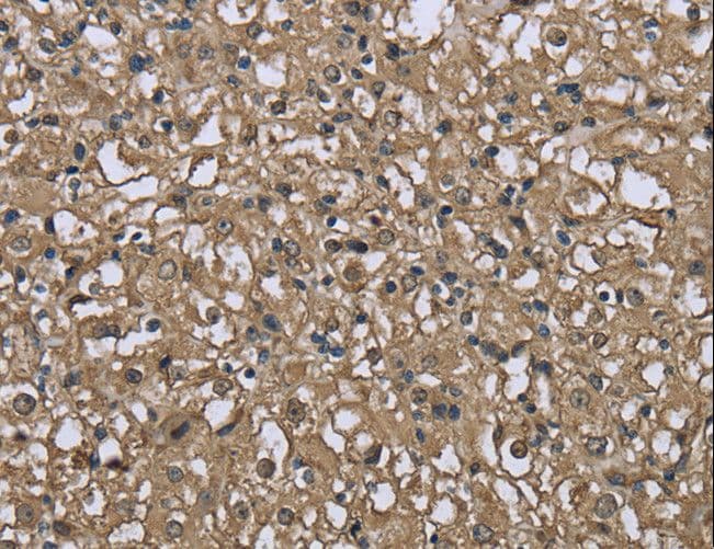 FBP1 Antibody