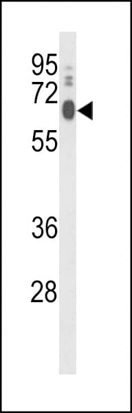 LPCAT1 / AYTL2 Antibody (aa506-534)