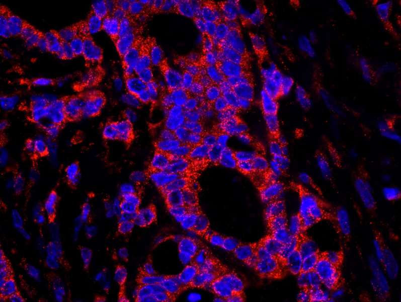 USP3 / UBP Antibody (aa471-521)