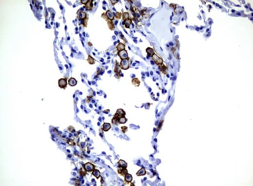 Monoclonal Mouse anti-Human CD32A Antibody (clone UMAB60, Carrier-free, IHC, WB)