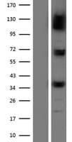 NPEPPS Protein (Over-Expression Lysate Myc-DDK (Flag))