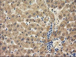 CAT / Catalase Antibody (clone OTI3C3)