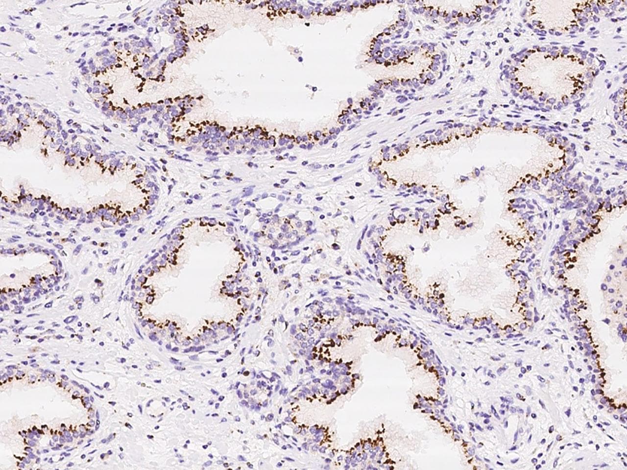 TM9SF2 Antibody