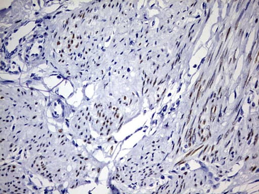 PR / Progesterone Receptor Antibody (aa1-298, clone OTI12D1)