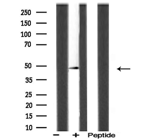 Polyclonal Rabbit anti-Human ACOT4 Antibody (IF, WB)