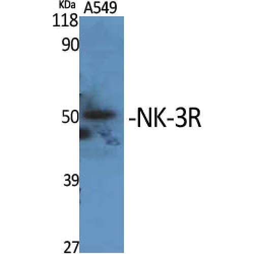 TACR3 / NK3R Antibody (370-450 aa, C-terminal)