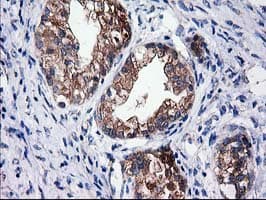 SULT1C2 / Sulfotransferase 1C2 Antibody (clone OTI4G1)