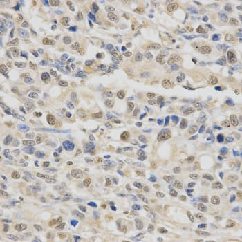 SPHK / SPHK1 Antibody