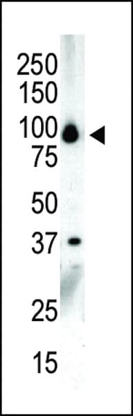 PKD3 / PRKD3 Antibody (aa860-890)