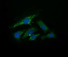IHC-plus™ UBE2G2 Antibody (clone 4D6)