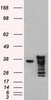 Monoclonal Mouse anti-Human DFFA / ICAD / DFF45 Antibody (clone OTI5C4, IF, WB)