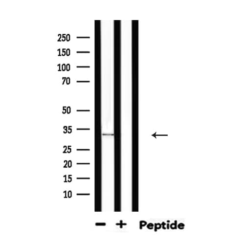 Polyclonal Rabbit anti-Human MYD88 Antibody (IHC, IF, WB)