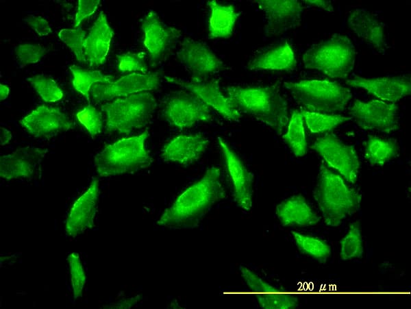 IHC-plus™ ACY1 / Aminoacylase 1 Antibody (clone 4F1-B7)