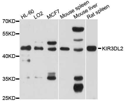 KIR3DL2 Antibody