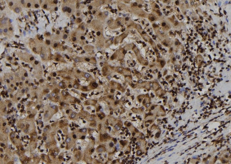 GSTP1 / GST Pi Antibody