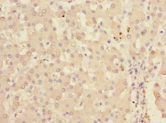 Polyclonal Rabbit anti-Human KHK / Ketohexokinase Antibody (IHC, WB)