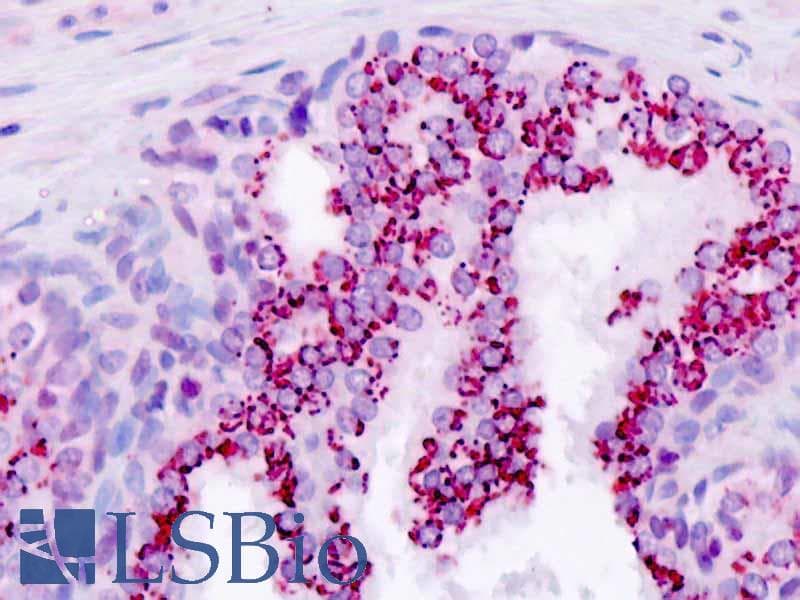 IHC-plus™ APRT Antibody (aa143-170)