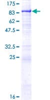Human PGM2L1 Protein (Recombinant GST)
