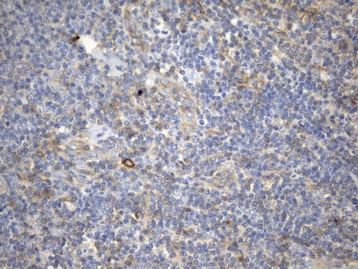 CD99 Antibody (clone UMAB262)