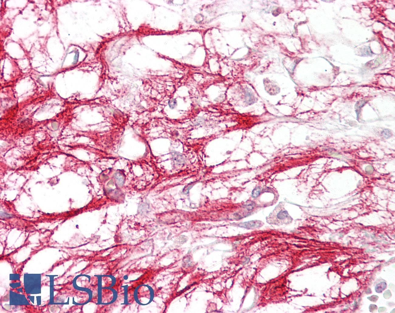 IHC-plus™ NRG1 / Heregulin / Neuregulin Antibody (aa198-229)