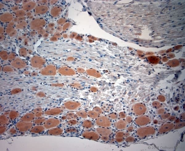 CACNA2D1 Antibody (aa600-650)