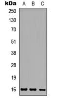 ATXN7L1 Antibody (Internal)