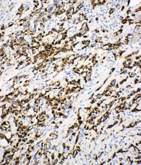 ECI1 / DCI Antibody (aa272-290)