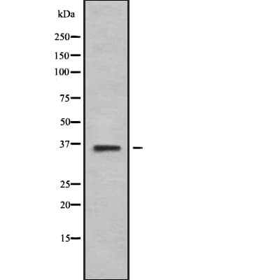 ADRB3 Antibody