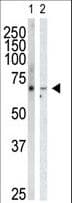 GRK6 Antibody (aa551-576)