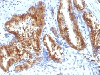 Polyclonal Rabbit anti-Human AMACR / P504S Antibody (IHC)