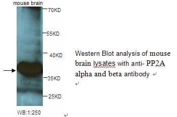 IHC-plus™ PP2Ac / PPP2CA Antibody