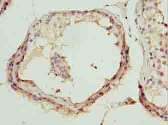 Polyclonal Rabbit anti-Human DDX55 Antibody (IHC)