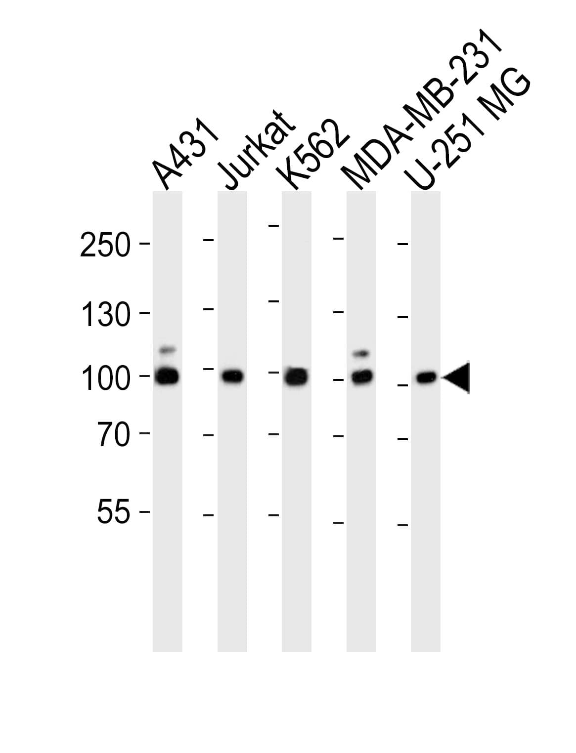 ZNF175 Antibody (aa150-187)