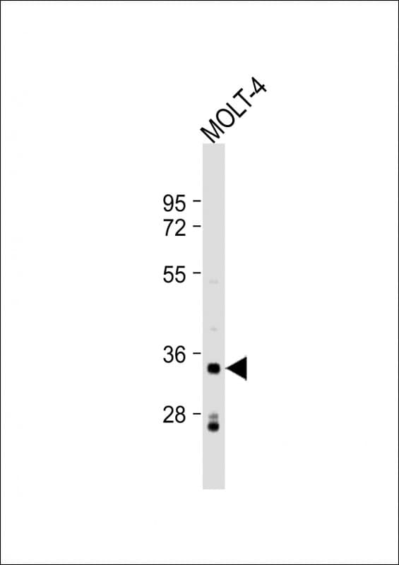 Polyclonal Rabbit anti-Human IMPA2 Antibody (aa48-82, WB)