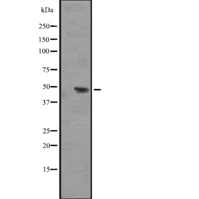 Polyclonal Rabbit anti-Human IL17RB Antibody (WB)