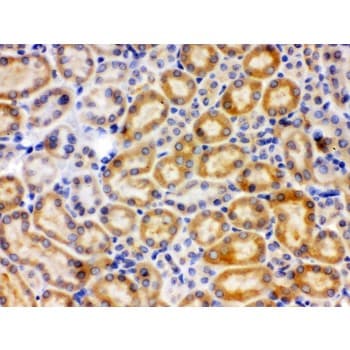 CYP27B1 Antibody (aa475-508)