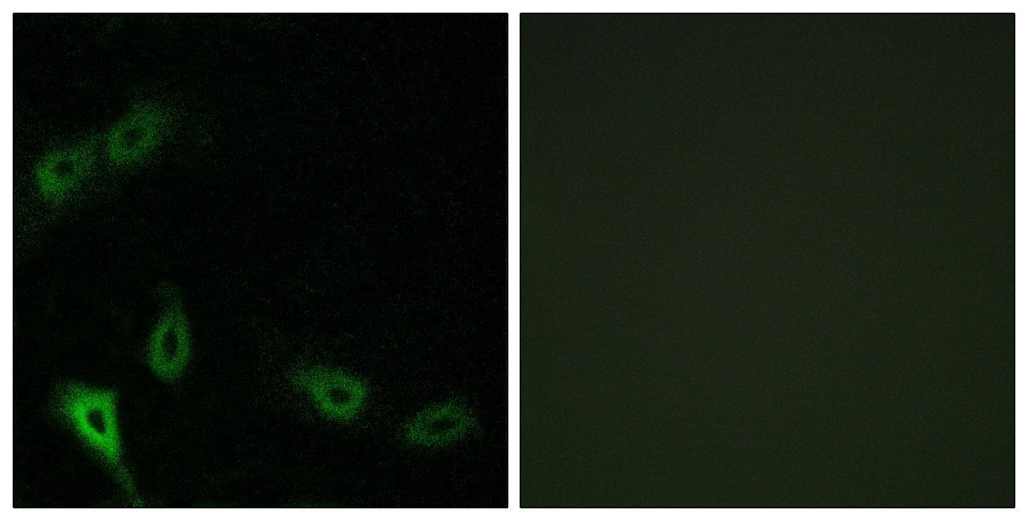 MARK2 Antibody