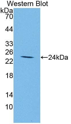 IGFBP2 / IGF-BP53 Antibody (aa148-325, FITC)